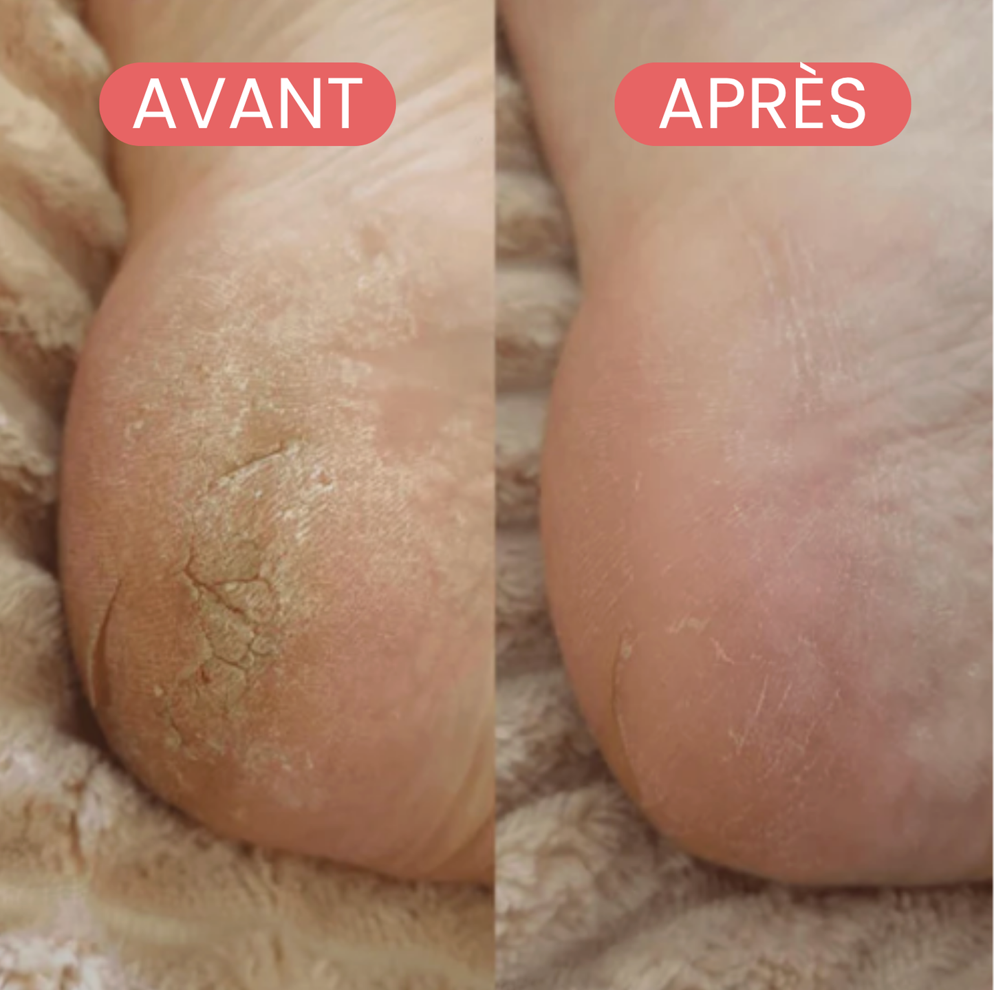 Lisséa, notre râpe pieds tout doux
