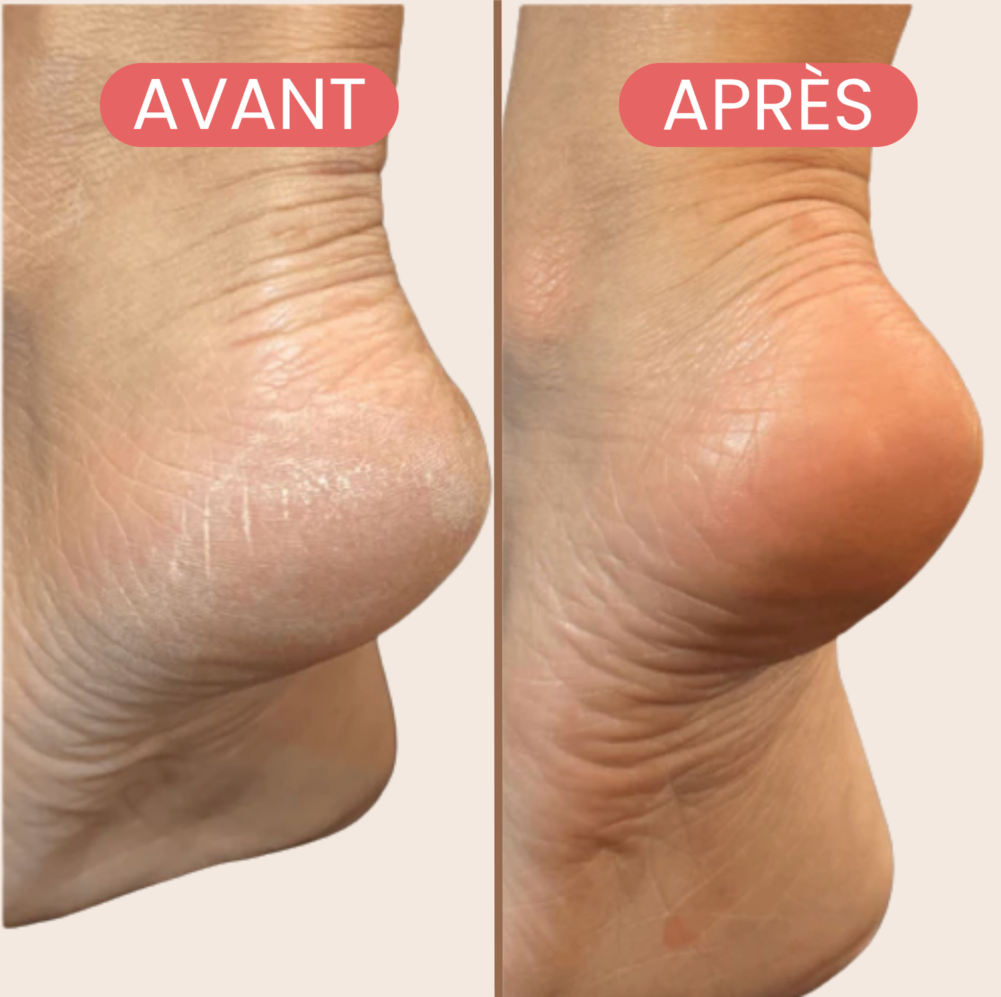 Lisséa, notre râpe pieds tout doux