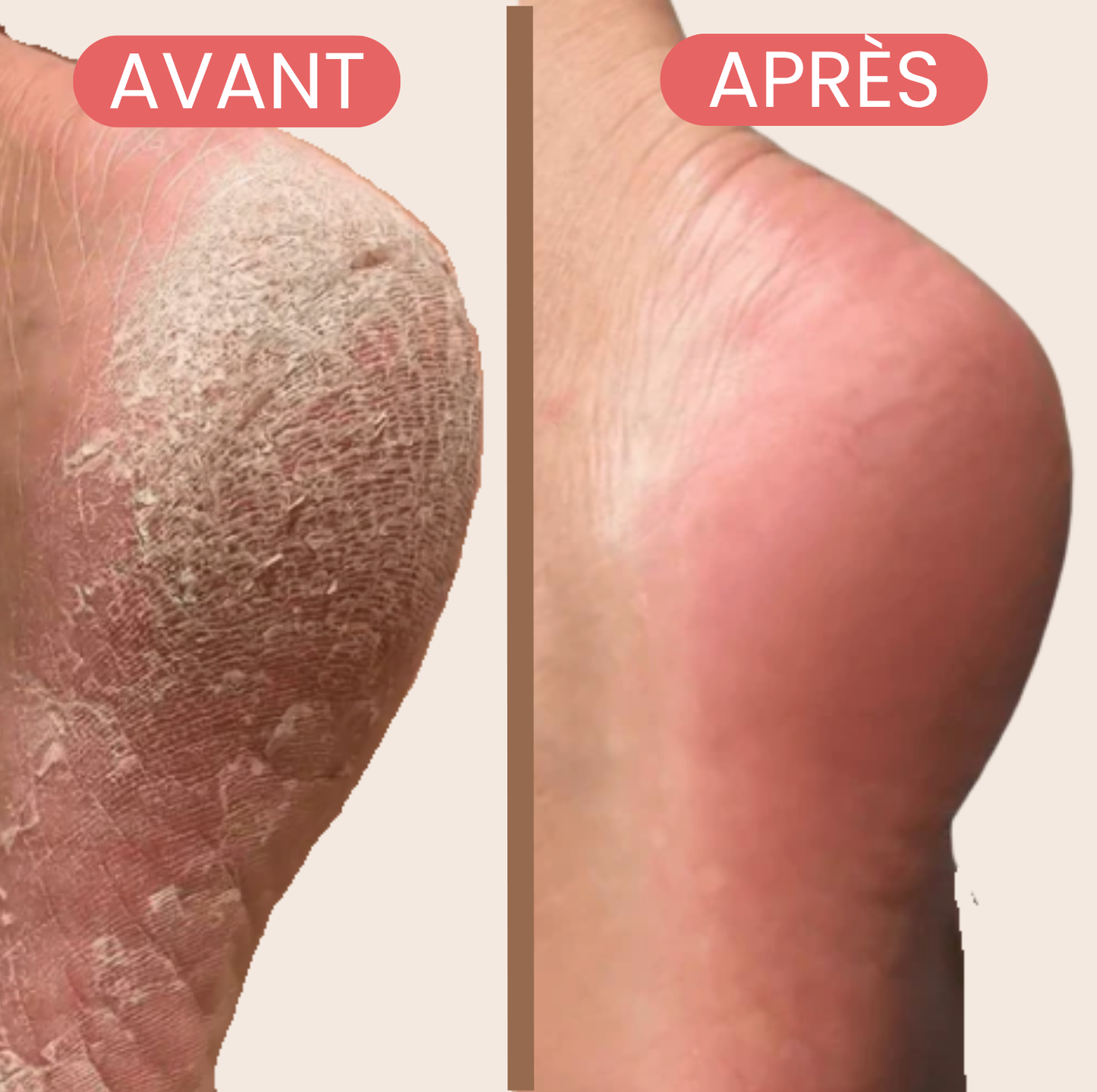 Lisséa, notre râpe pieds tout doux